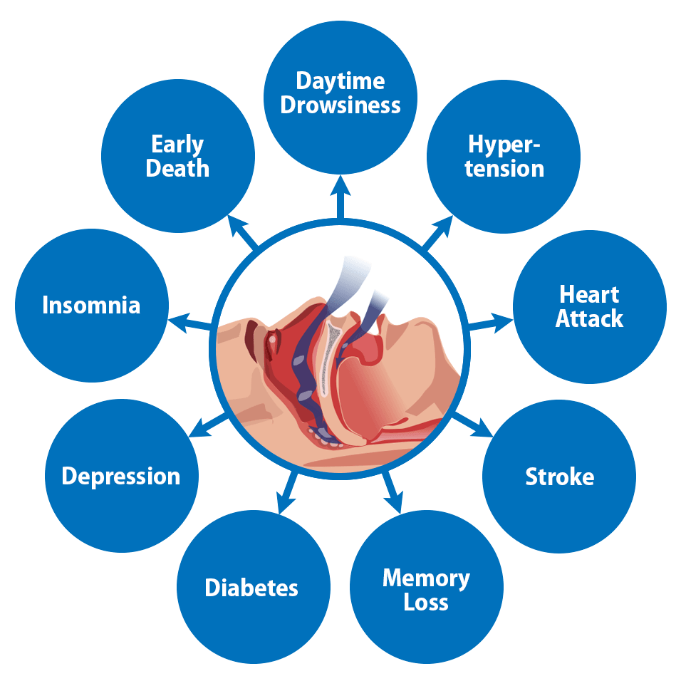 The health effects of sleep apnea: serious risks